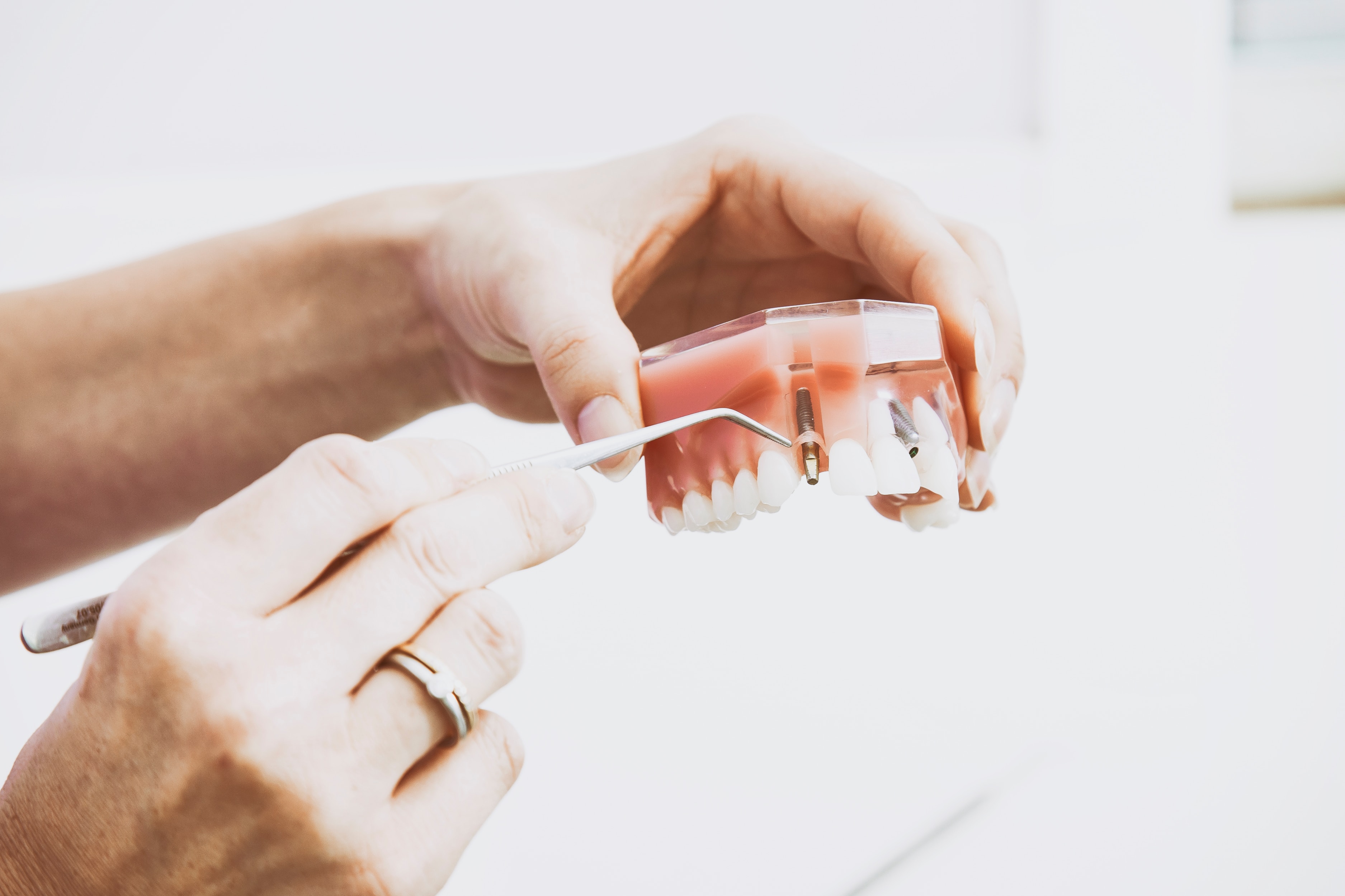 Denture model